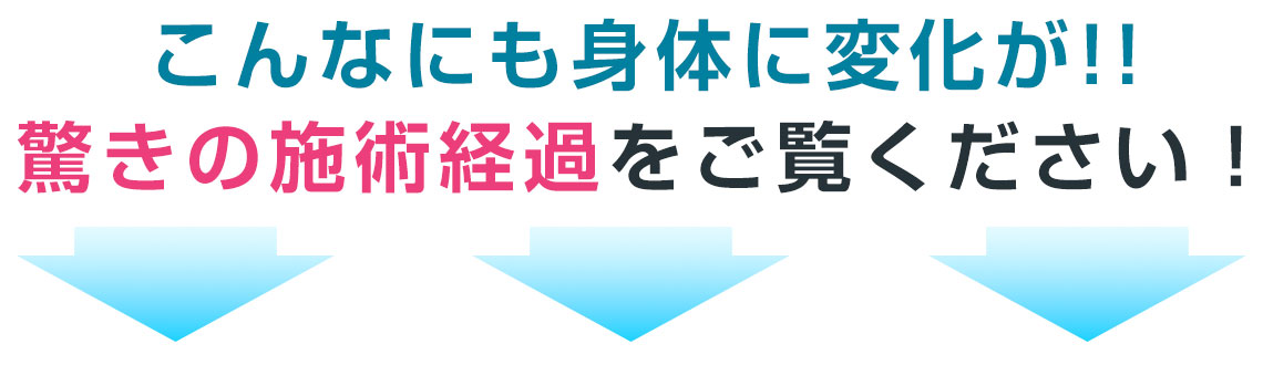こんなにも身体に変化が!!驚きの施術経過をご覧ください！