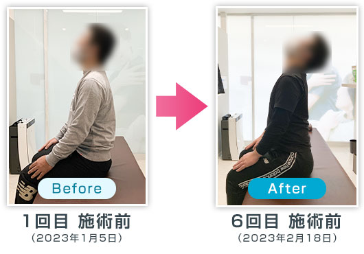 ビフォーアフター